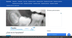 Desktop Screenshot of hipoplasia.com