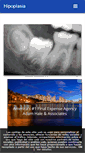 Mobile Screenshot of hipoplasia.com