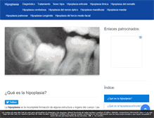 Tablet Screenshot of hipoplasia.com